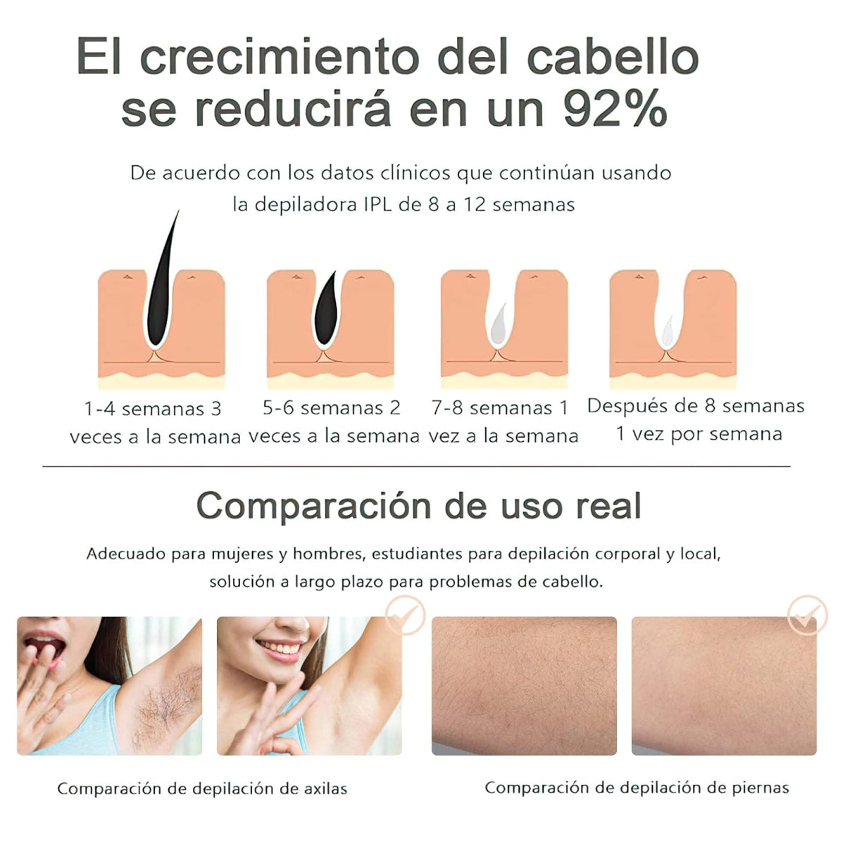 IPL SmoothSkin™ | Depilador Láser Profesional